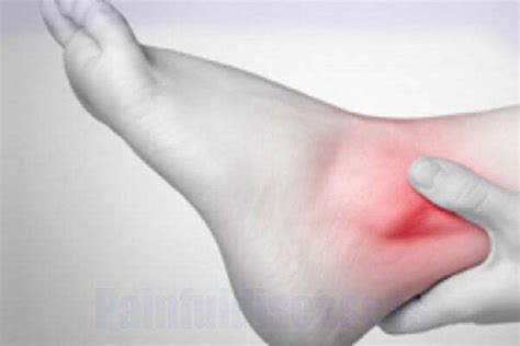 Ankle Pain At Night Causes And Treatment Painful Diseases