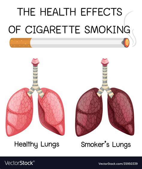 Poster On Health Effects Cigarette Smoking Vector Image Sexiz Pix