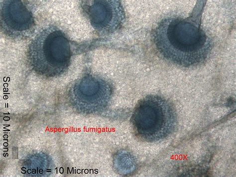 Mold Of The Week Aspergillus Fumigatus Is One Of The Most Common