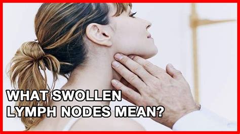What Swollen Lymph Nodes Mean Youtube
