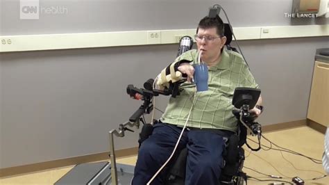 Paralyzed Man Moves Hand Cnn Video