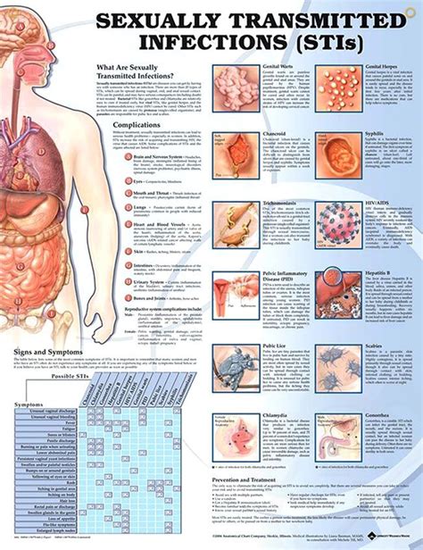 sexually transmitted infections chart 20x26 medical education sexually transmitted medical