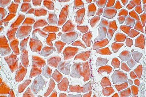 Tissu Humain En Coupe De Peau Sous La Vue De Microscope Photo Stock