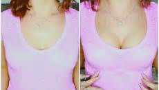She can achieve a fuller look with the desired cleavage appearance. Upbra Before and Afters