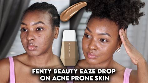 Fenty Beauty Eaze Drop Blurred Skin Tint On Acne Prone And Textured Skin