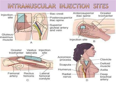 intramuscular injection nursing procedures nurse medical education