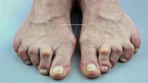 15 Signs And Symptoms Of Foot Problems And What They Reveal About Your