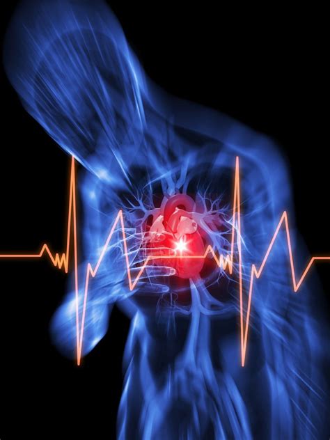 Sudden cardiac arrest is the abrupt loss of heart function, breathing and consciousness. Cardiac arrest - Harvard Health