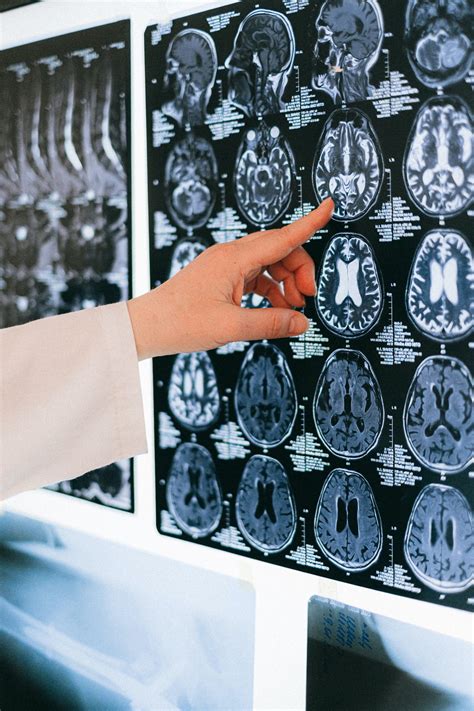 Neuroimaging Three Important Brain Imaging Techniques Sciu