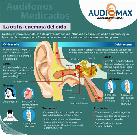 Pin En Audifonos Medicados Lima Audiomax