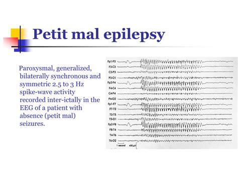 Ppt Eeg Findings In Patients With Neurological Disorders Powerpoint