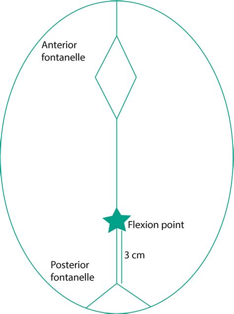 Diagram Of The Fetal Head Showing The Position Of The Flexion Point