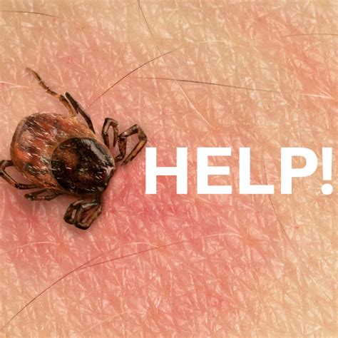 Help Ive Gotten A Tick Bite Now What Do I Do