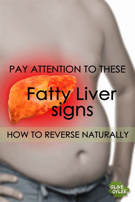 Fatty Liver Signs And How To Reverse It Oliveoylee
