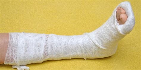 When To Fix A Broken Ankle Huffpost Life