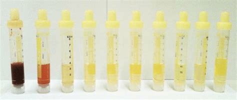 Initial Dilution Series 110 Over 9 Dilutions Plus Pure Urine Sample