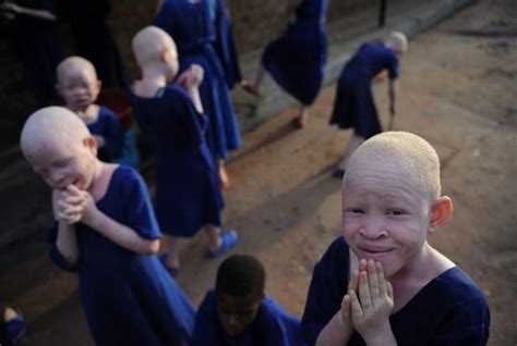 14 Creepy Beliefs And Facts About The Ritualistic Killing Of Albinos
