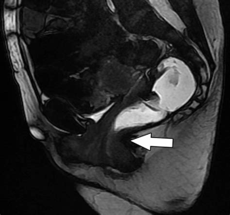 Figure 1 From Mr Imaging Based Assessment Of The Female Pelvic Floor Semantic Scholar