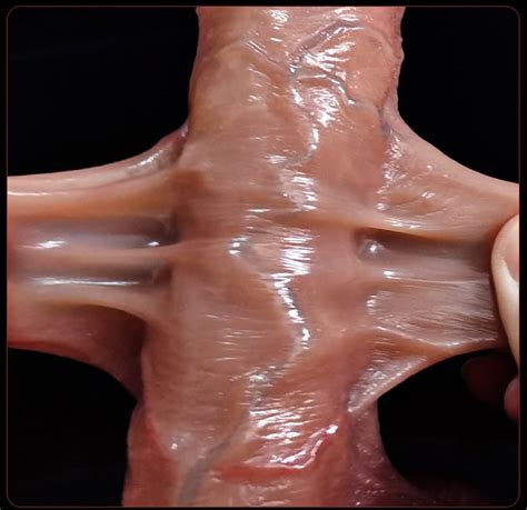 Simulation Dildo Realistic Sliding Foreskin 21 5Cm G Spot Stimulate