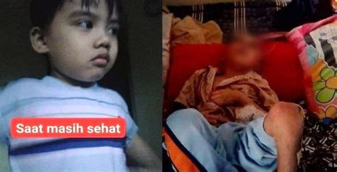Viral Bocah 7 Tahun Di Bandung Diduga Dianiaya Orangtua Kandung Hingga