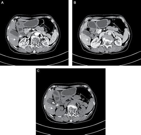 Figure 2 From International Medical Case Reports Journal Dovepress