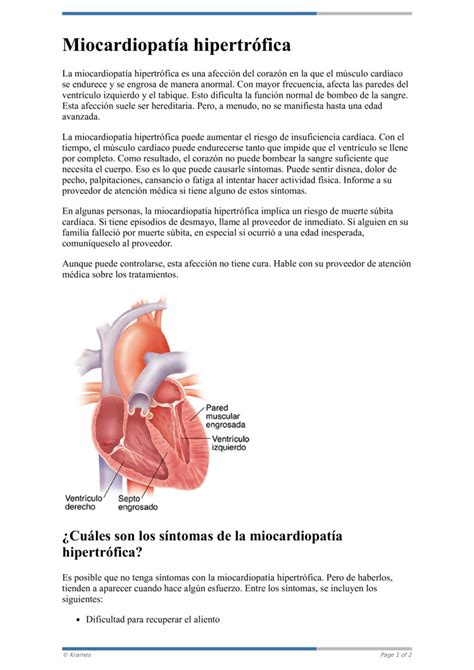 Text Miocardiopatía hipertrófica HealthClips Online