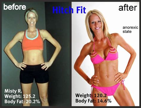 They're willing to use unhealthy and extreme measures to control their calorie intake. Welcome to Phil's blog: Anorexia Nervosa!!! Signs You Are ...