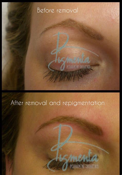 Permanent Makeup Correction - Pigmenta