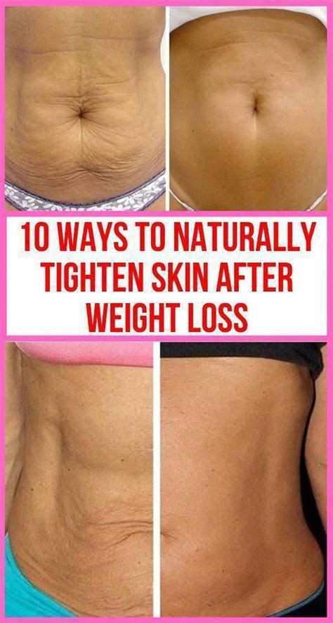 Incredible How To Get Rid Of Sagging Lower Belly Skin Ideas Unity Wiring