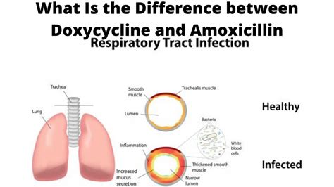 What Is The Difference Between Doxycycline And Amoxicillin Youtube