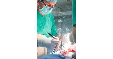Surgical Smoke Regulation Begins To Clear