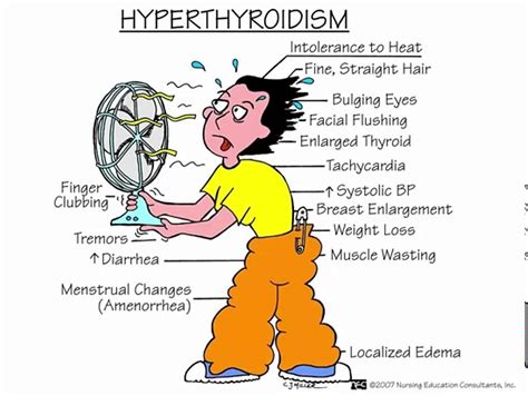 Hyperthyroidism Youtube