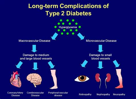 Diabetes Melitus Tipe 2 Fatimah