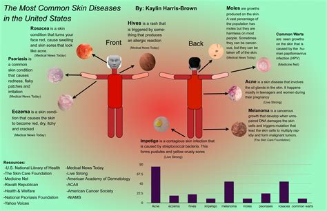Infographic The Most Common Skin Diseases In The Us Sli Skin