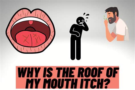 Why Is The Roof Of My Mouth Itchy Causes And Treatments