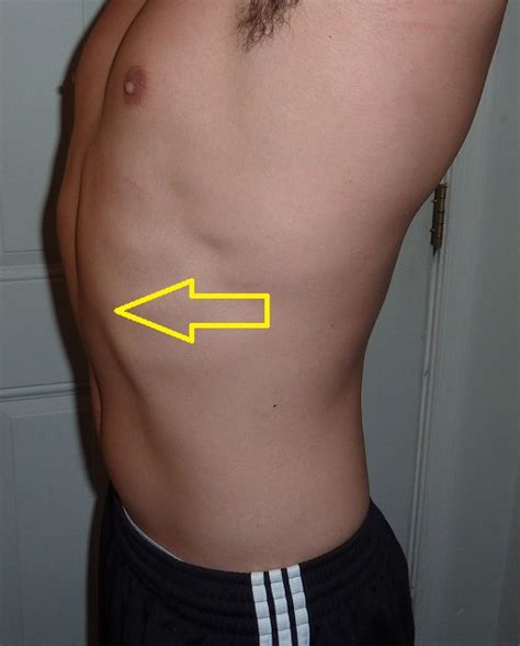 Should We Train The Rectus Abdominis Robertson Training Systems