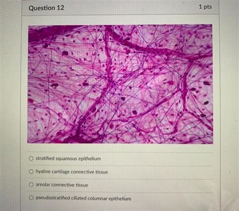 Solved Question 10 Motor Neuron Hyaline Cartilage Connective Chegg
