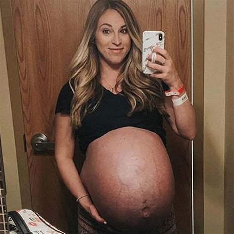Mom Of Quadruplets Shares Awe Inspiring Before And After Pregnancy Images While Opening Up About