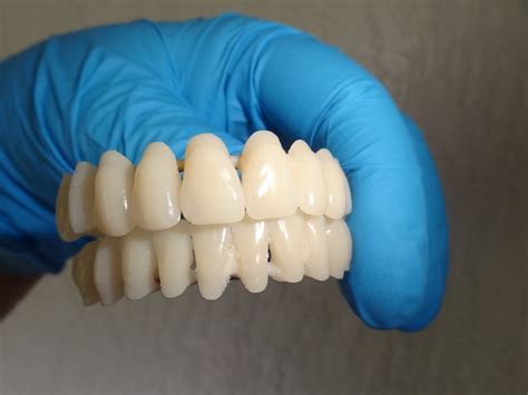 Diy Denture Kit Upper And Lower Custom Dentures Full Denture Etsy