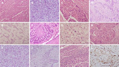 Changing Role Of Histopathology In The Diagnosis And Management Of