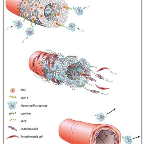 Proposed Mechanism Of Neovessel Formation After Implantation Of A