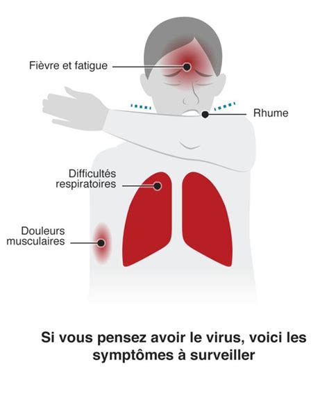 Coronavirus quels sont les derniers symptômes BBC News Afrique