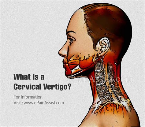What Is A Cervical Vertigo Know Its Causes Treatment And Prevention
