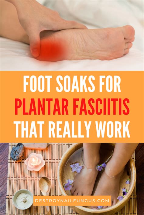 The Best Home Remedies And Foot Soaks For Plantar Fasciitis