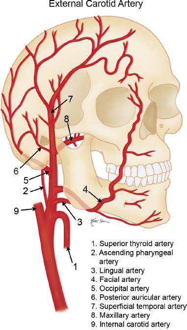 5 Vascular Abnormalities Radiology Key