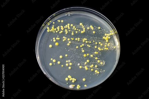 Bacteria Grown From Skin Smear Colonies Of Micrococcus Luteus And