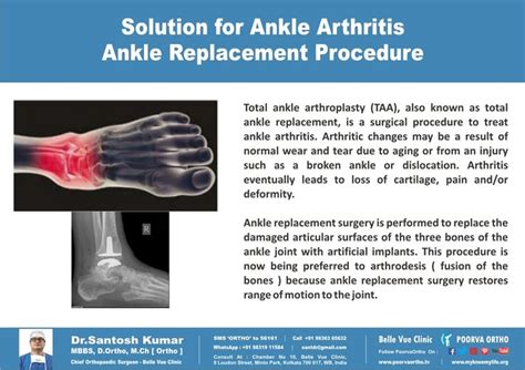 What Is The Solution For Ankle Arthritis Ankle Replacement Procedure