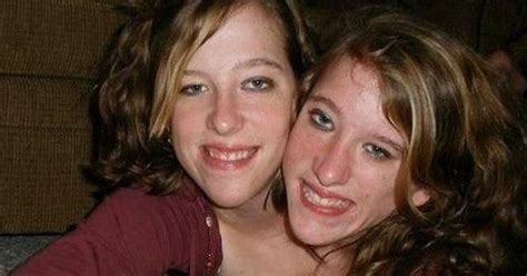 Conjoined Twins Abby And Brittany Hensel Are All Grown Up Now Jesus Daily