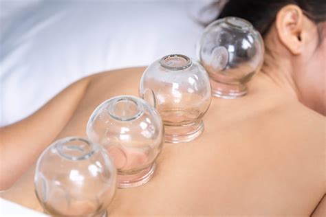Is Cupping Scientifically Proven To Work Firedout