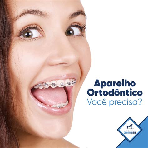 Realize O Sonho De Ter Seus Dentes Alinhados Ortodontia Aparelho Floripa Ilhadamagia